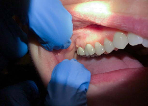 Best Emergency Root Canal Treatment in Mountain Lodge Park, NY